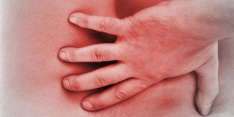 Bedsores or Pressure Ulcers